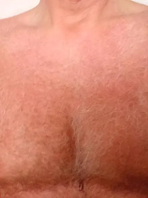 baerli_fun